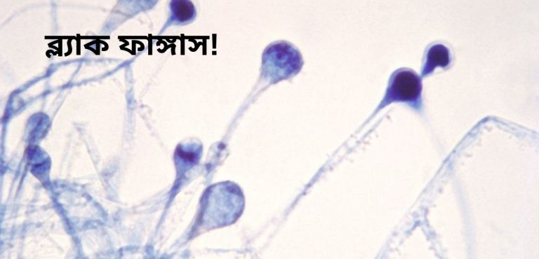 ব্ল্যাক ফাঙ্গাস