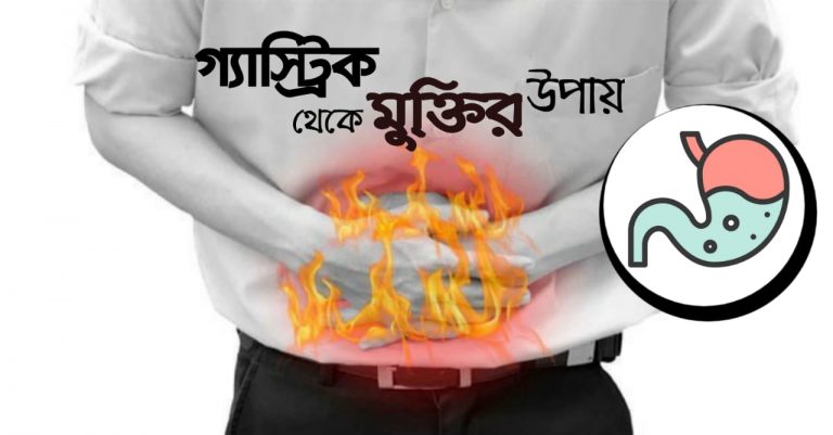 গ্যাস্ট্রিক-থেকে-মুক্তির-উপায়