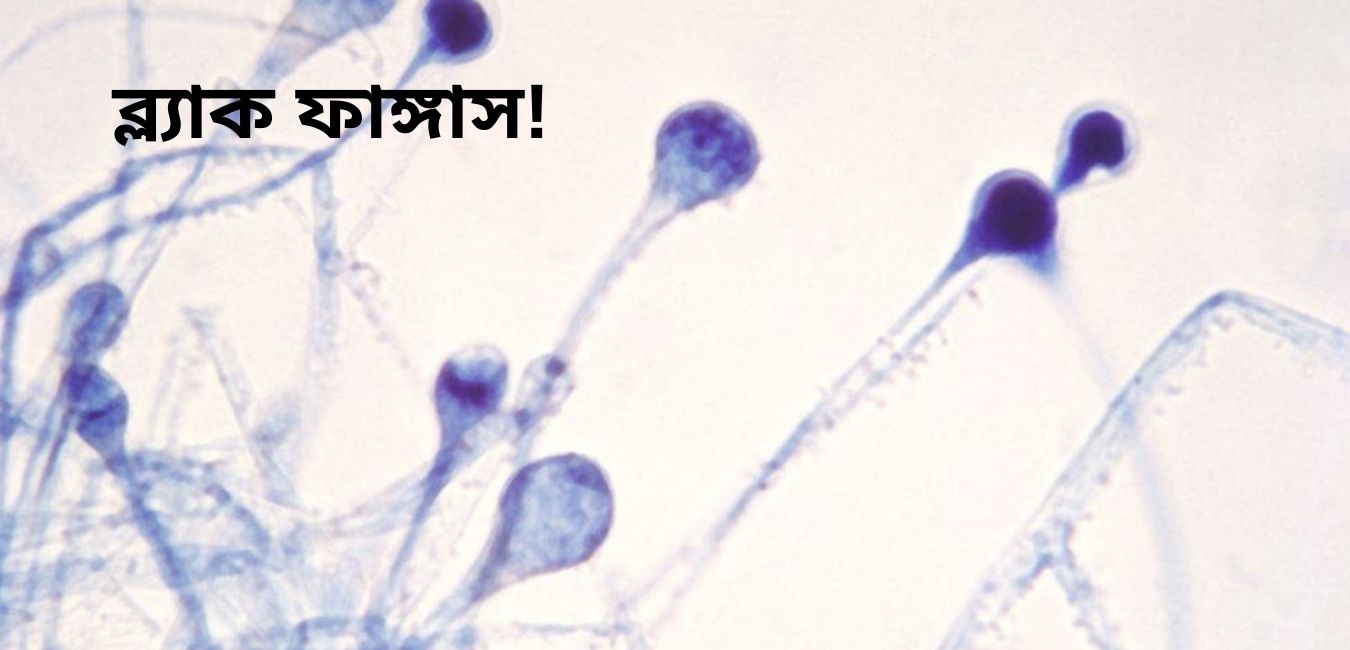 ব্ল্যাক ফাঙ্গাস