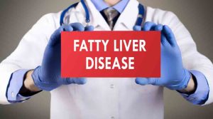 fatty liver treatment