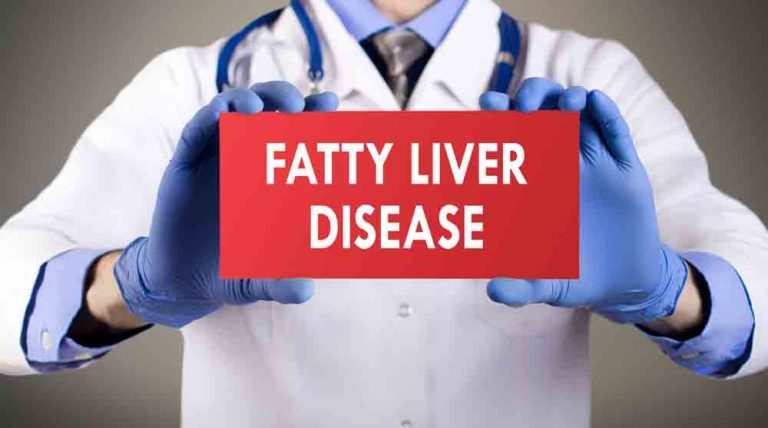 fatty liver treatment