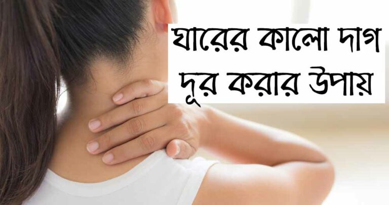 ঘাড়ের কালো দাগ দূর করার উপায়