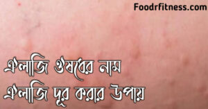 এলার্জি ঔষধ এর নাম