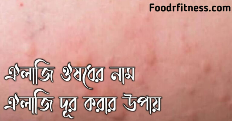 এলার্জি ঔষধ এর নাম