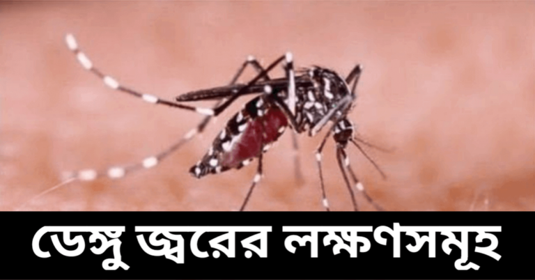 ডেঙ্গু জ্বরের লক্ষণসমূহ